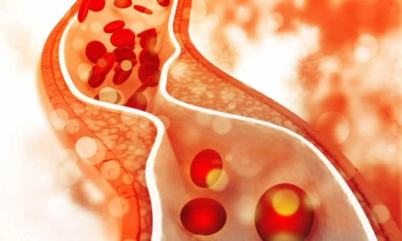 Come abbassare il colesterolo senza rinunciare al gusto: il trucco approvato dai cardiologi Come abbassare il colesterolo senza rinunciare al gusto: il trucco approvato dai cardiologi