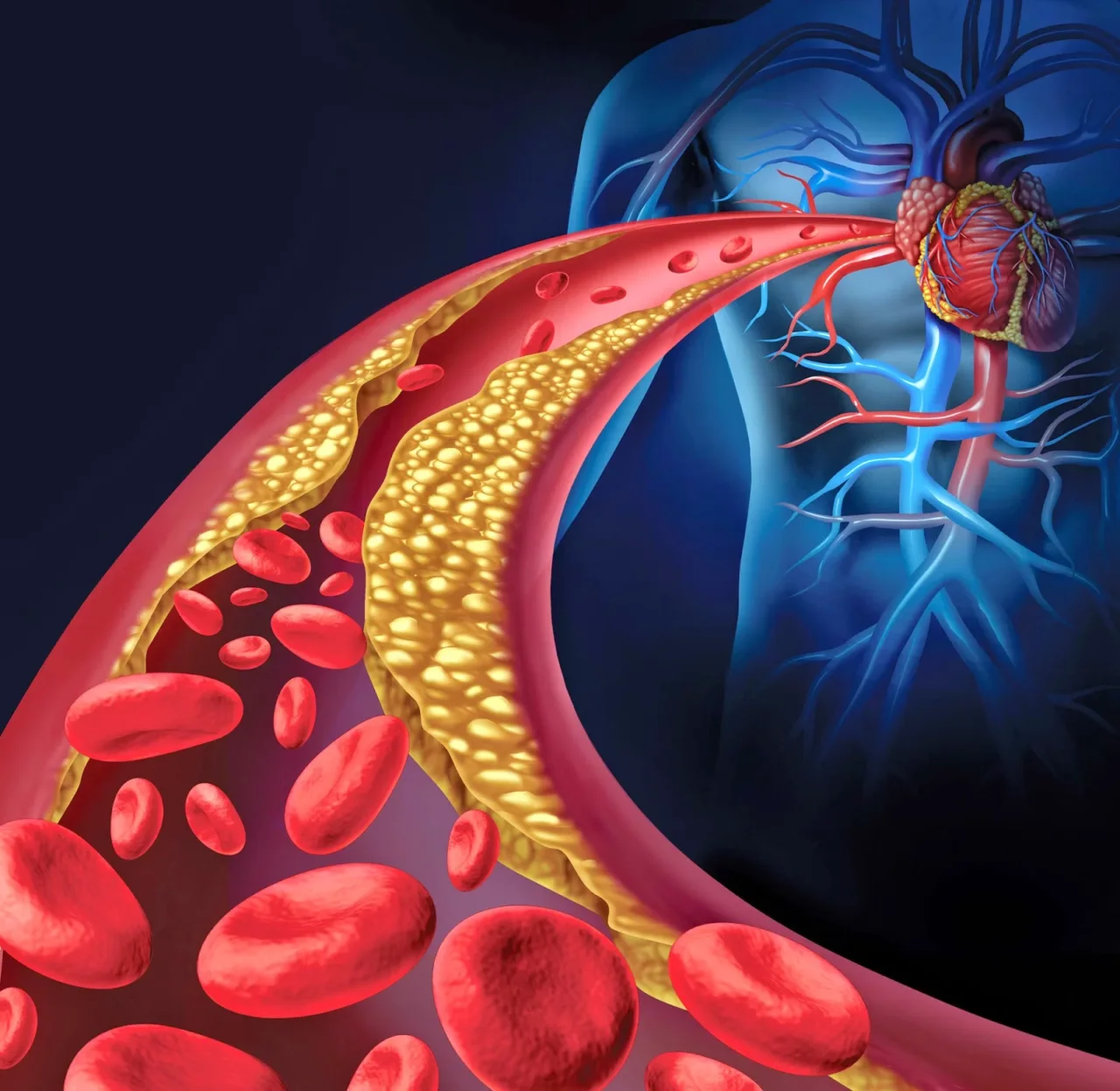 Come abbassare il colesterolo dopo i 50 anni: il nuovo piano alimentare approvato dai cardiologi Come abbassare il colesterolo dopo i 50 anni: il nuovo piano alimentare approvato dai cardiologi